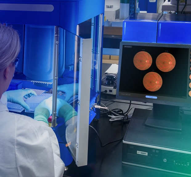 AIRA, an AI retina analyzing and disease diagnosis tool